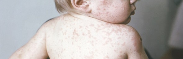 Colorado Doctor Among Those Fired from Critical Vaccine Advisory Committee